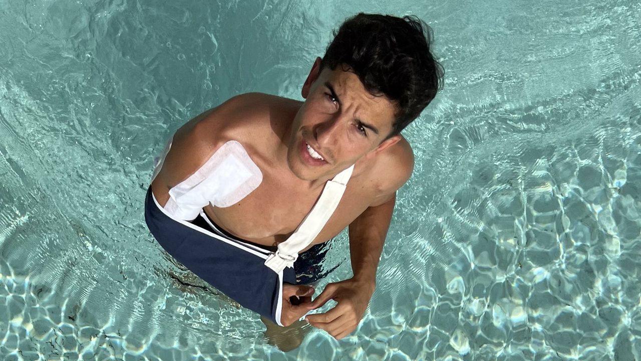 Dos semanas después de su operación, Marc Márquez se recupera en casa (Foto: @marcmarquez93)