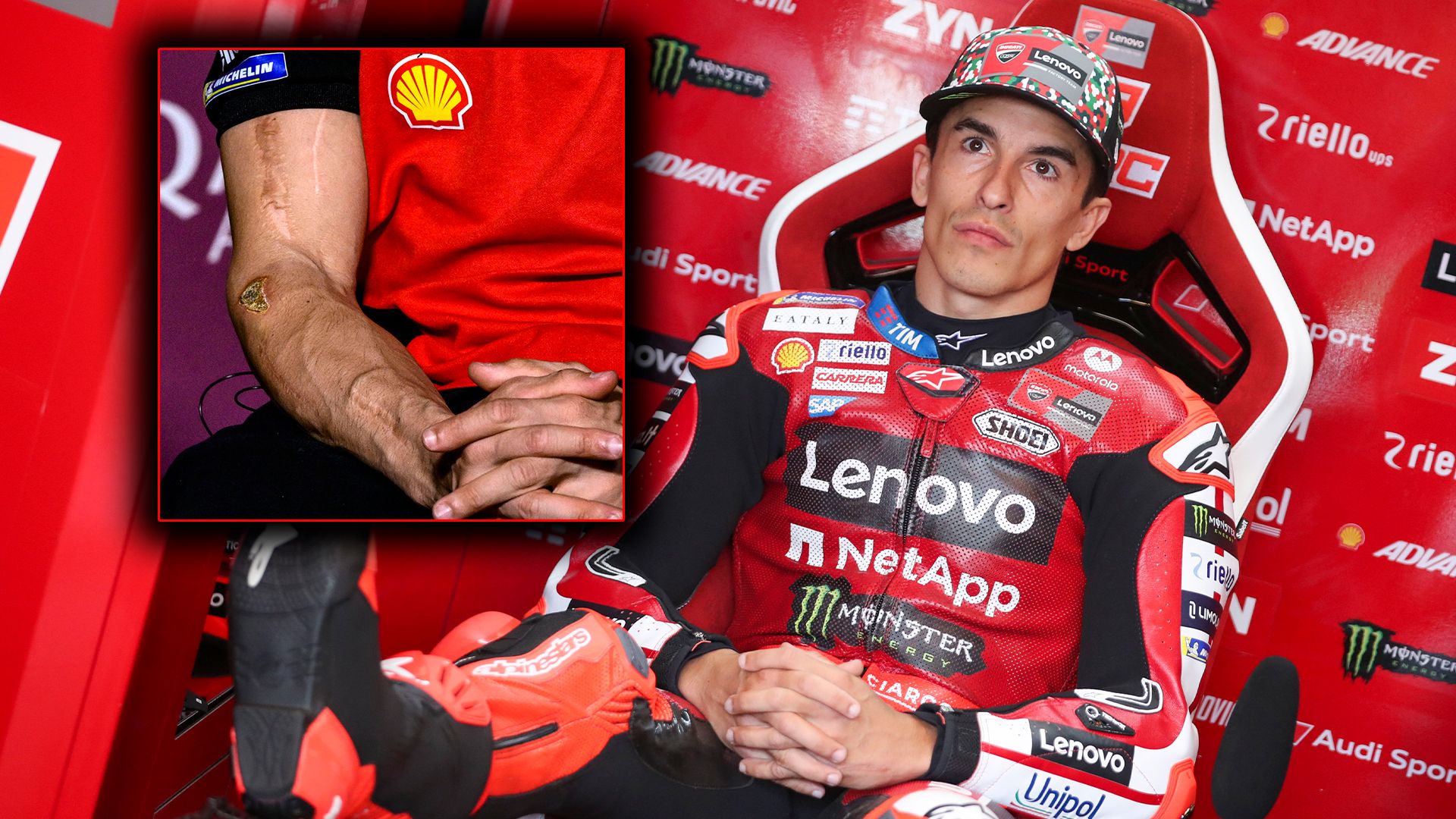"He visto a Marc Márquez cansado y dolorido, pero contento": el análisis de Hospitality MOTOCICLISMO
