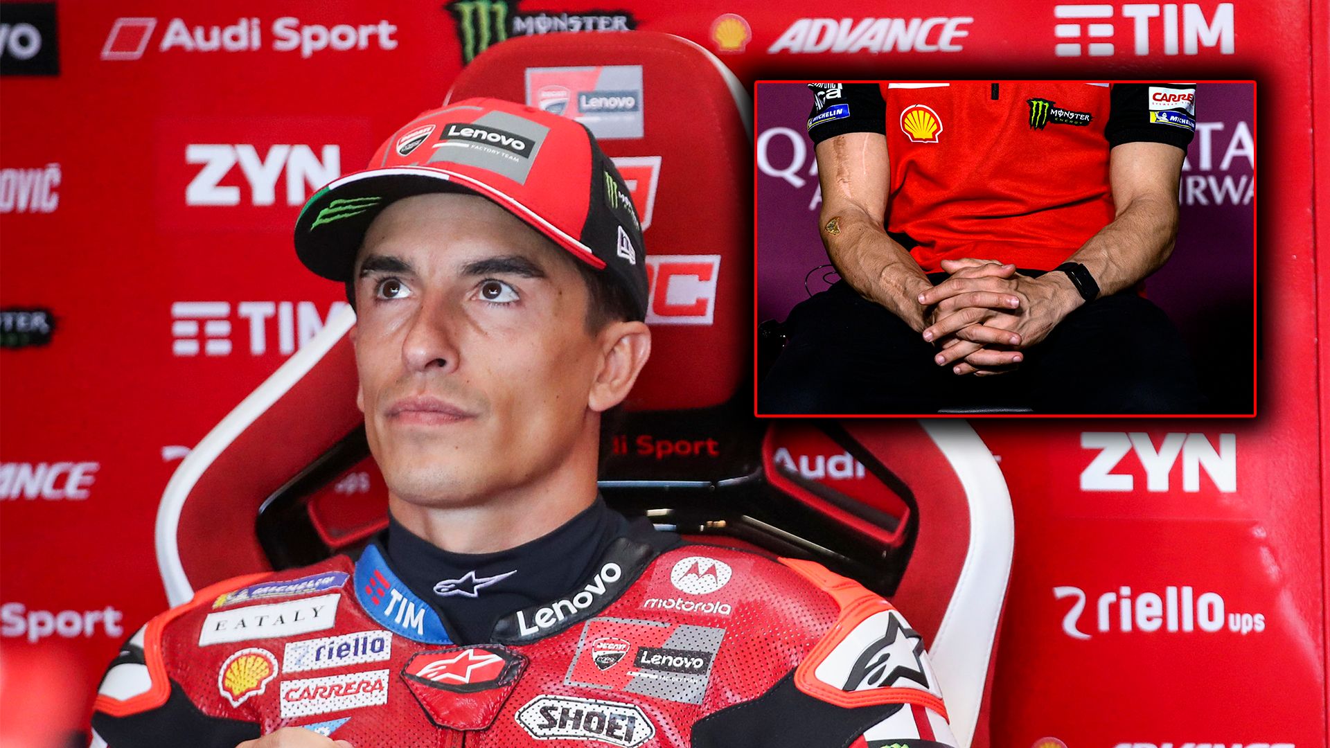 El médico que operó a Marc Márquez explica el estado real de su brazo: “Corre con un brazo y medio”