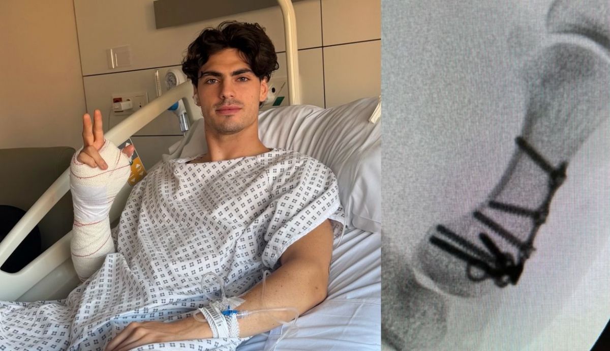 Fermín Aldeguer ha sido operado de una fractura en la base del primer hueso metacarpiano de su mano derecha