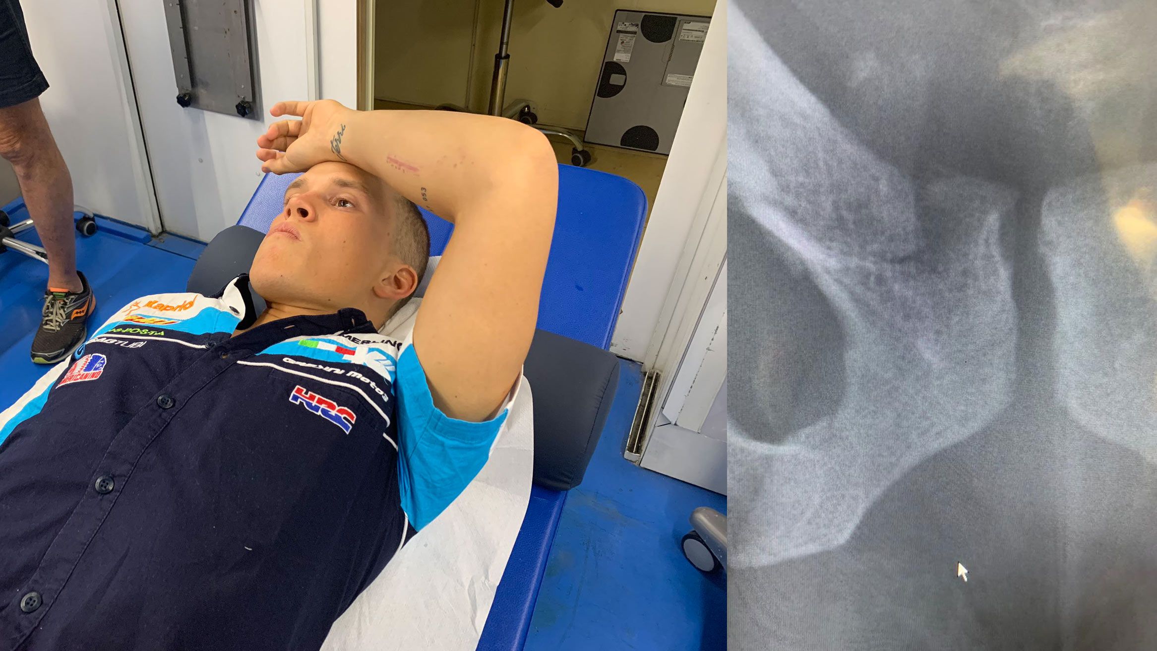 Gabri Rodrigo ko: se rompe clavícula y pelvis